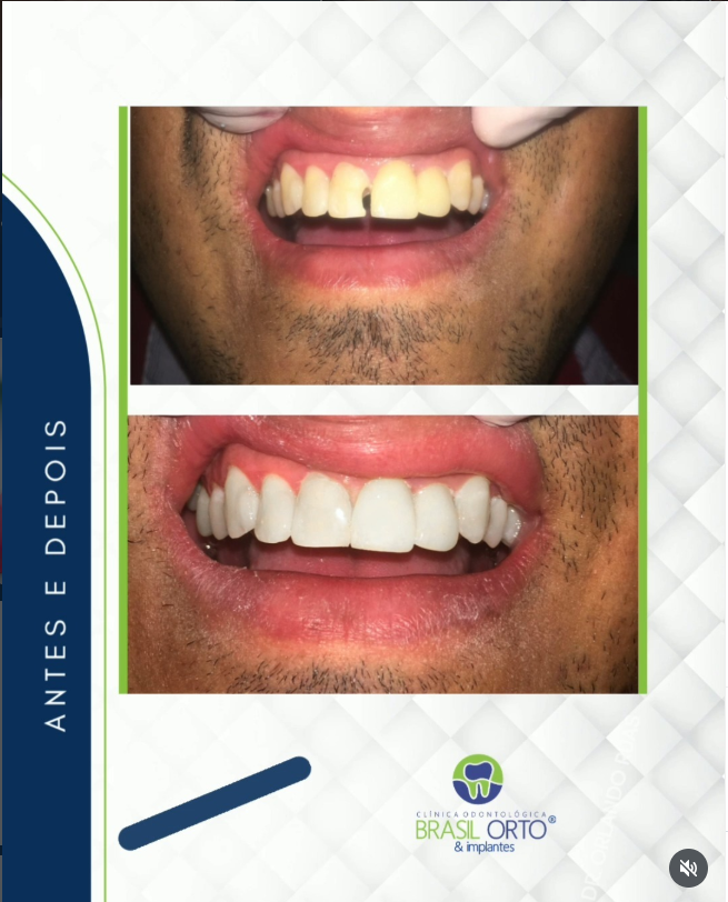 Brasil Orto & Implantes Brasil Orto & Implantes