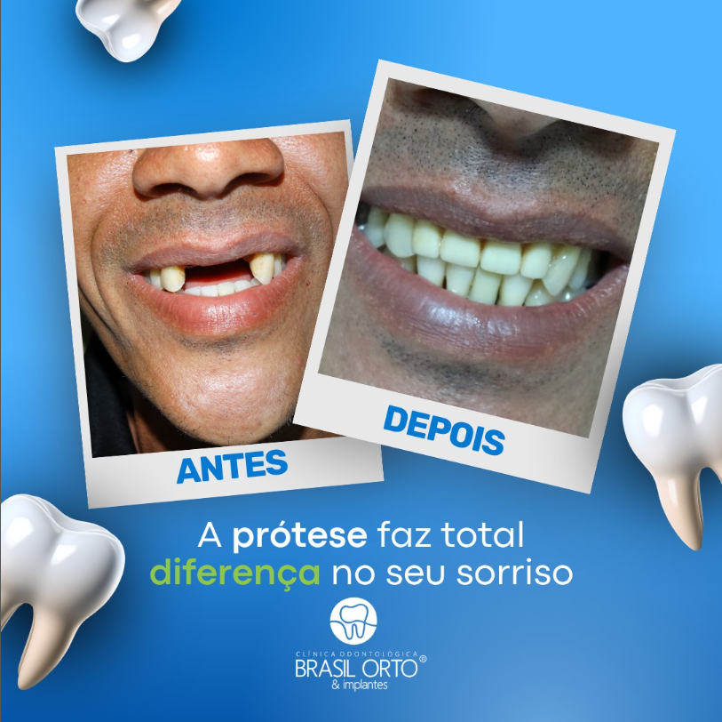 Brasil Orto & Implantes